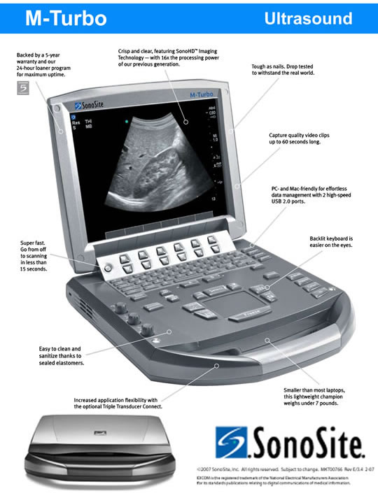 SonoSite